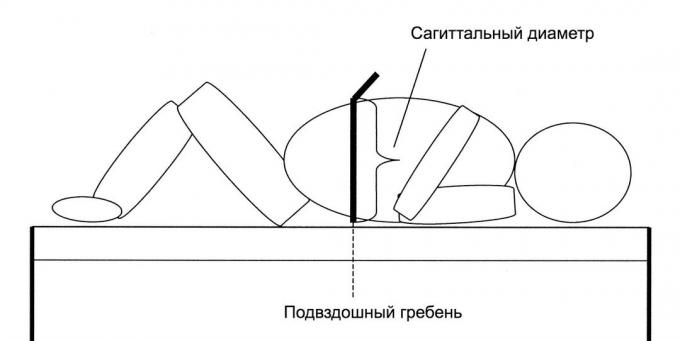 Висцерална мазнина. сагитален диаметър